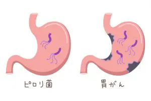 食器 ピロリ菌 ストア 子供