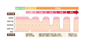 胃の病気（胃潰瘍・十二指腸潰瘍・胃がん・十二指腸がん・急性胃炎