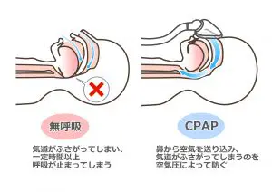 その他の疾患 | 【米沢市の消化器・内視鏡内科】きだ内科クリニック